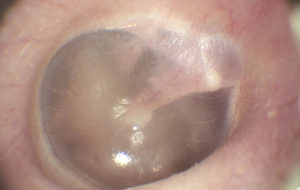 Total Exam Device Human Ear